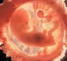Poroda 12 tjedna trudnoće