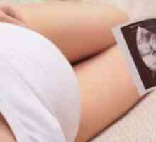 18 Tjedana trudnoće - bez perturbacija