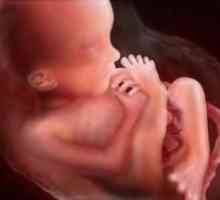 19 Tjedana trudnoće - mjesto fetusa