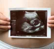 21 Tjedna trudnoće - fetalni veličina