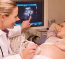26 Tjedna trudnoće - fetalni veličina