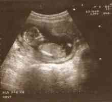 6 Tjedna trudnoće - što se događa?