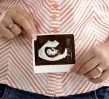 6 Tjedana gestacije - fetalni razvoj