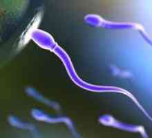 Agregacija spermija
