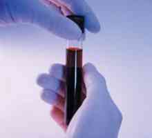 Test krvi za trudnoću