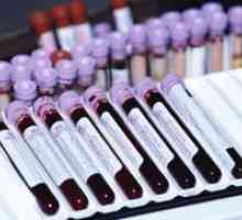 Krv u onkologiji