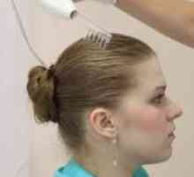 Androgene alopecije kod žena - liječenje
