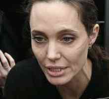 Angelina Jolie u bolnici