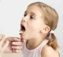 Grlobolja kod djece - simptomi