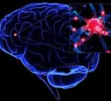 Angioma mozak