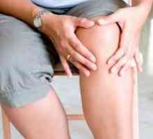 Artritis - Liječenje narodnih lijekova