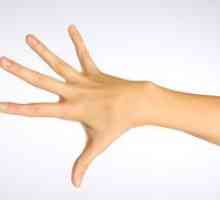 Artritis prsti