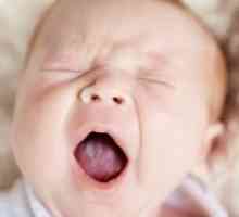 Bijeli jezik u dojenčadi