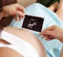 Trudnoća 26 tjedana - fetalni razvoj