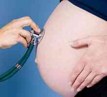 Korionski resica Uzorkovanje tijekom trudnoće