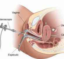 Biopsija endometrija