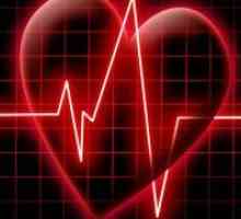 Opasna sinusna aritmija srca?