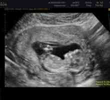 Fetalni otkucaji srca na 12 tjedana