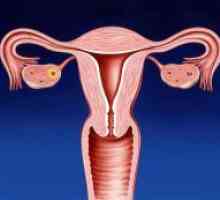 Što je cerviks u žena?
