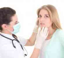 Dermatitis na licu - Liječenje