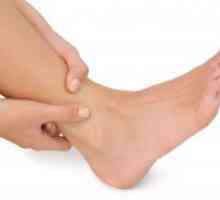 Dermatitis na nogama