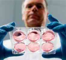 Produženo uzgoj embrija in vitro