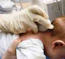 Zašto mozak ultrazvuk bebe