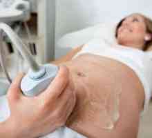 Dopler ultrazvuk u trudnoći - što je to?