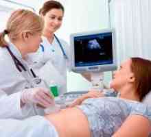 Dopler ultrazvuk u trudnoći - pravila