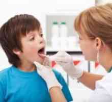 Faringitis u djece - liječenje