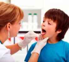 Faringitis kod djece - simptomi i tretman