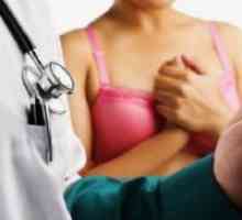 Fibroadenomatosis dojke