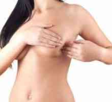 Fibrom dojke