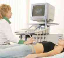 Fibromatoze maternice
