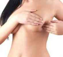 Fibromatoze dojke
