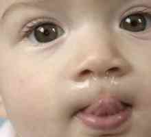 Fiziološka curenje iz nosa u dojenčadi