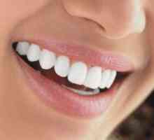 Fluoridizaciji zuba