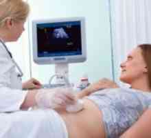 Hematom na ranoj trudnoći