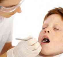 Brtvljenje zubi u djece
