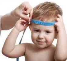 Hidrocefalus kod djece