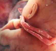 Fetalna hipoksija - simptomi