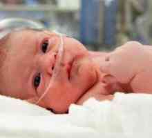 Hipoksija u novorođenčadi - što je to?