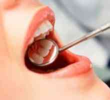Zub granulom