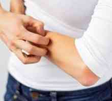 Kolestaza - simptoma, liječenje