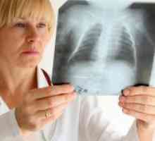 Kronični opstruktivni bronhitis
