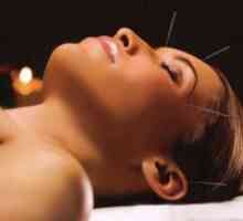 Akupunktura - kontraindikacije