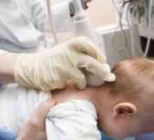 Cerebralna ishemija u novorođenčadi