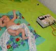 Elektroforeza za dojenčad