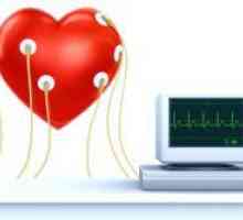 Elektrokardiogram srce - prijepis