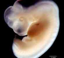 Embrija 6 tjedana